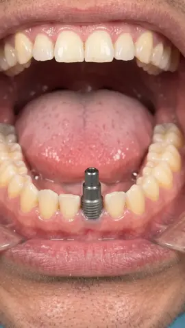 @pigfun0 outlier video