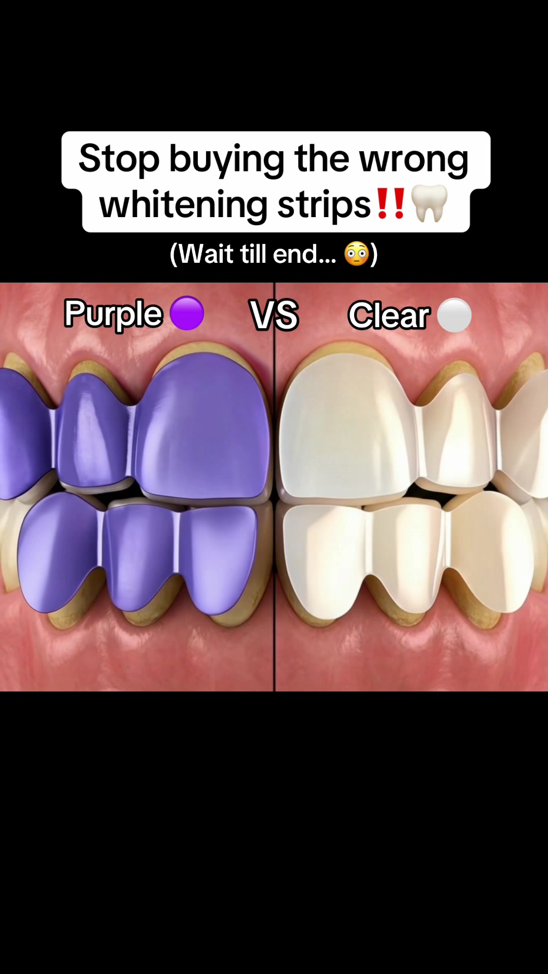 Stop buying the wrong whitening strips!! (Wait till end...) - TikTok hook example