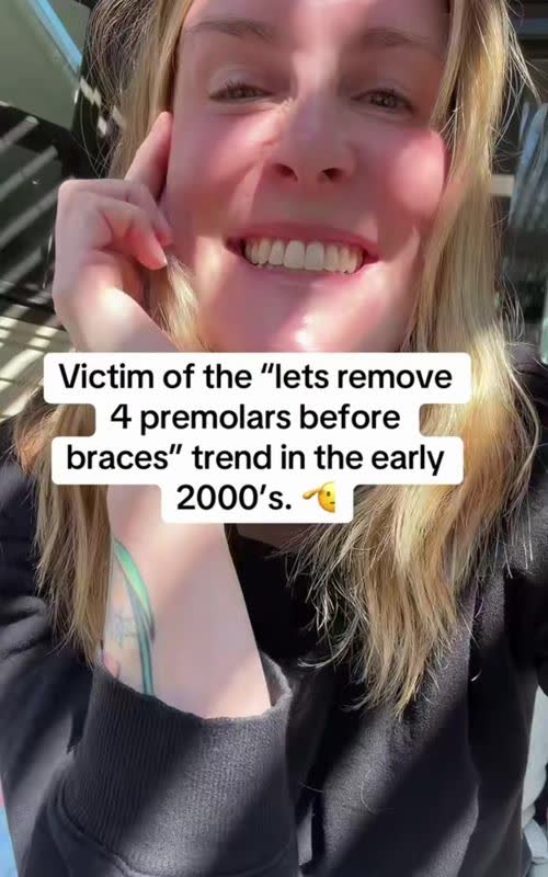 Oh, my god. I relate to this video so much because that was literally me. I had four of my premolars removed before braces. - TikTok hook example