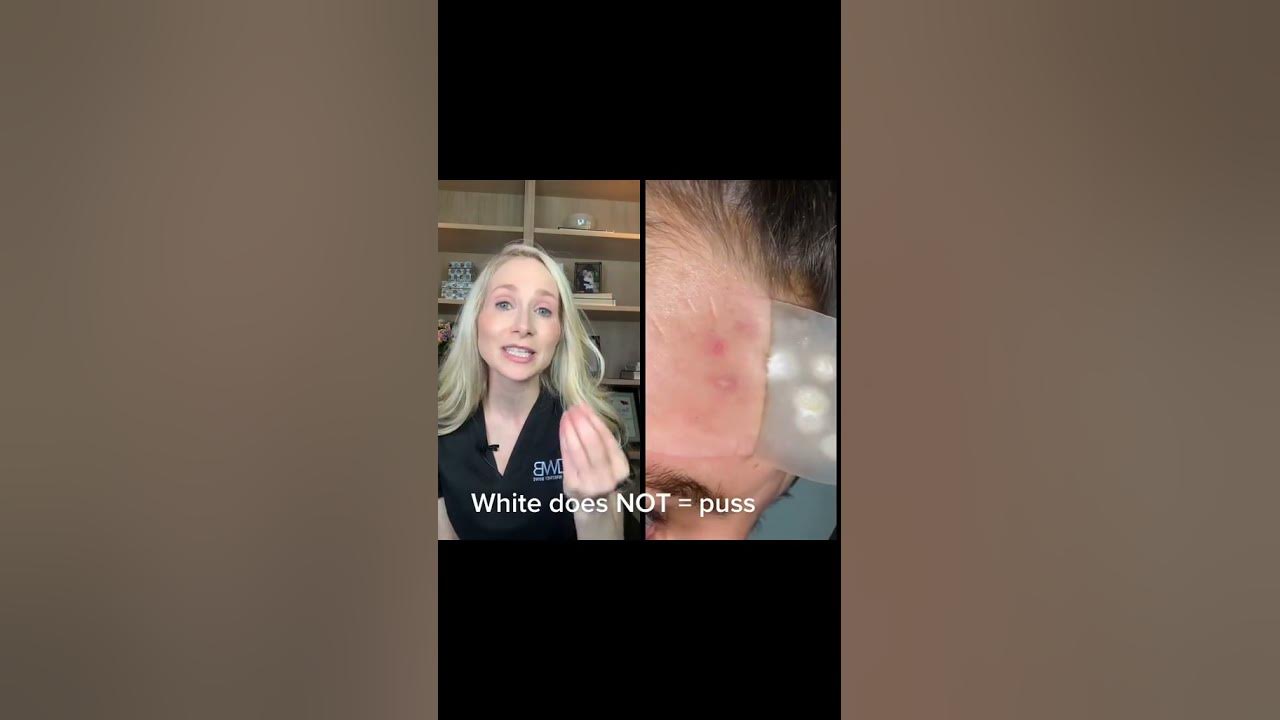 @DrWhitneyBowe outlier video