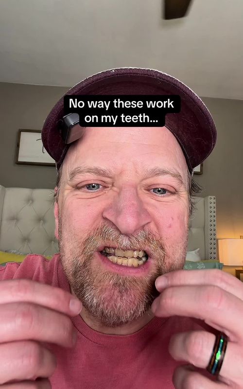 No way these work on my teeth... - TikTok hook example