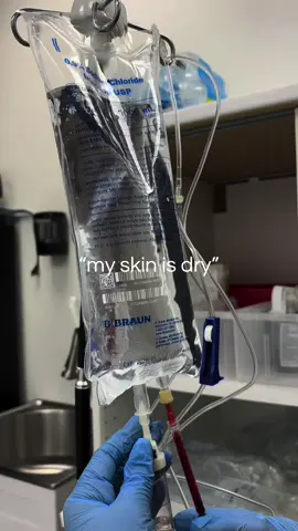 @vitalityivdripspa outlier video