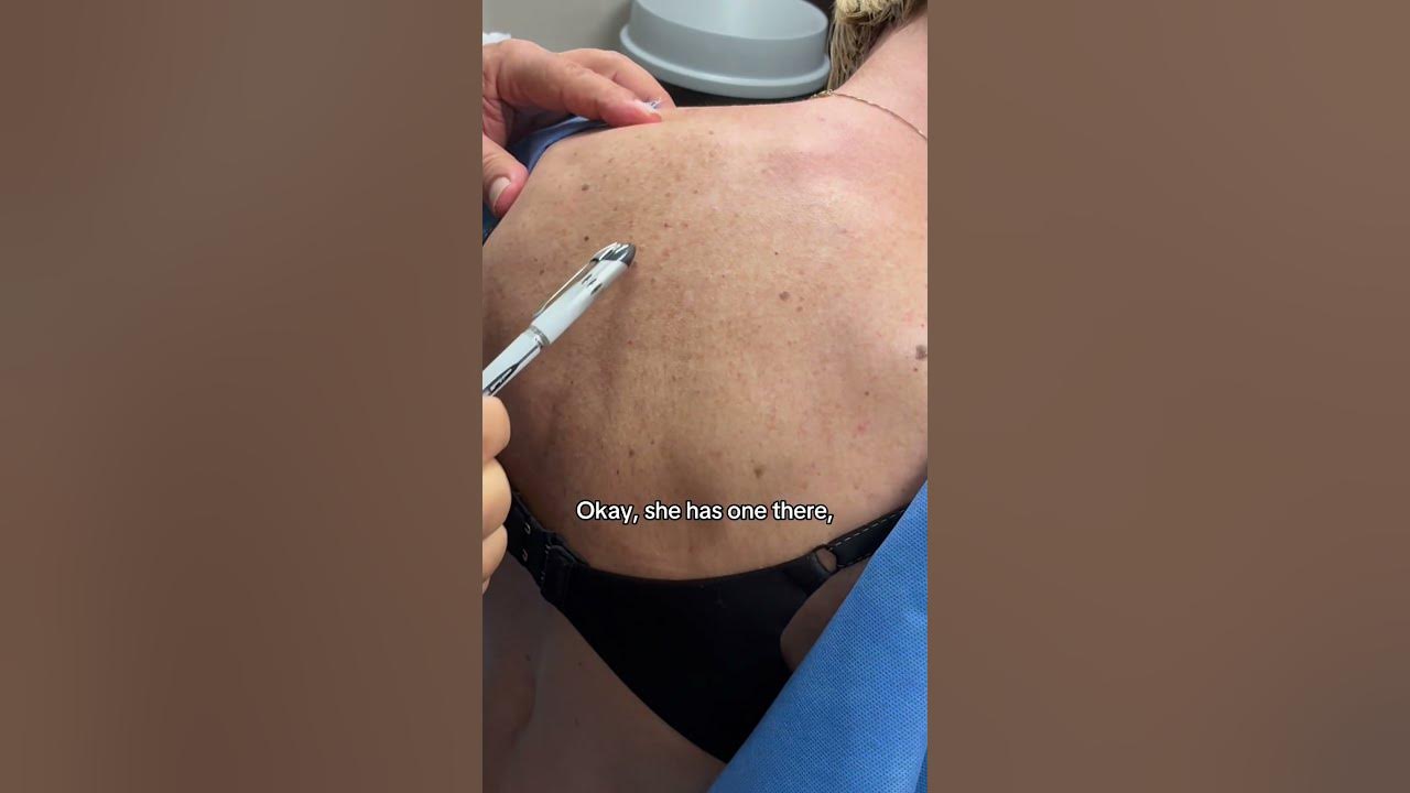 @dermatologistschoiceskincare outlier video